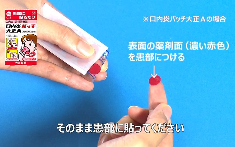 불꽃패치 포스팅